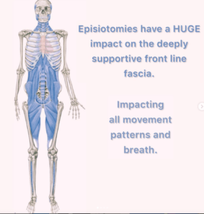 Impact on the front line fascia of episiotomies
