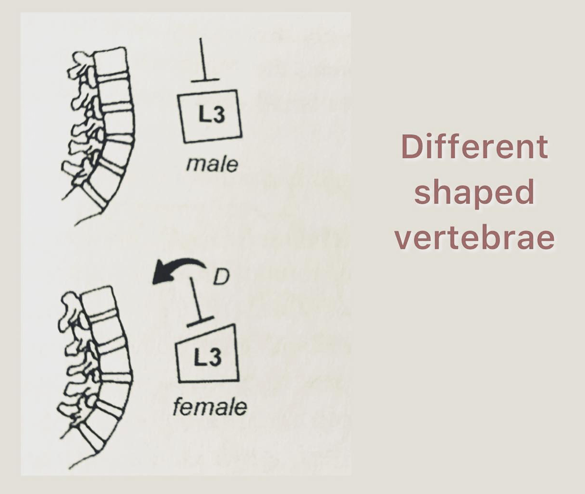 Different shaped verterbrae in men and women